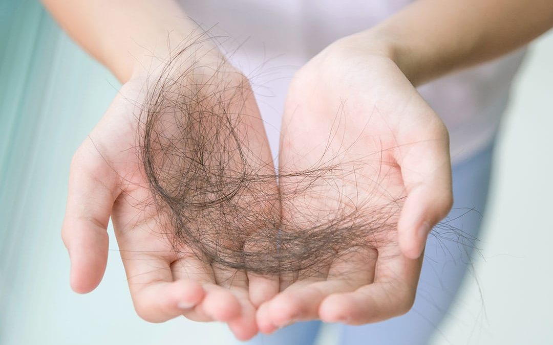 Haarwerk bij Alopecia